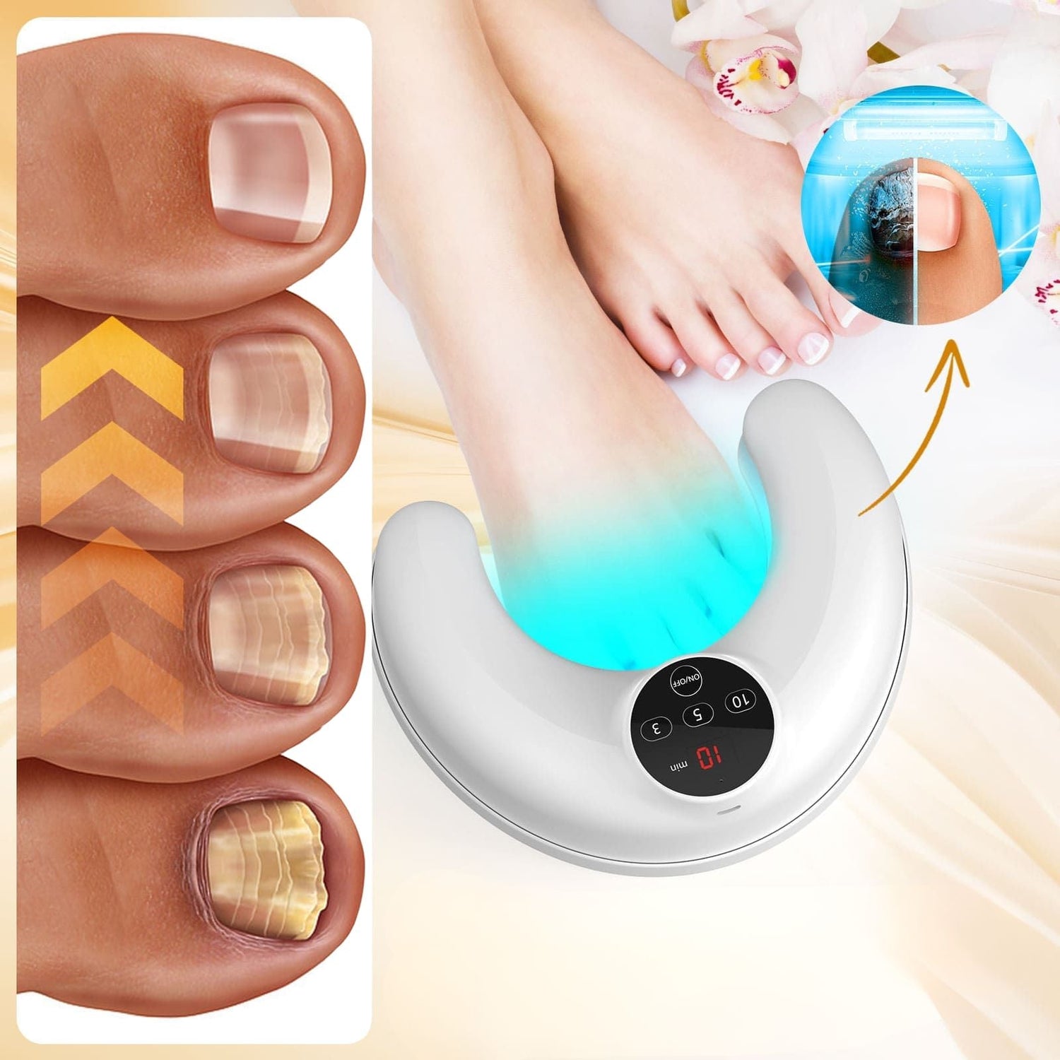 Soin ongulaire sans fil