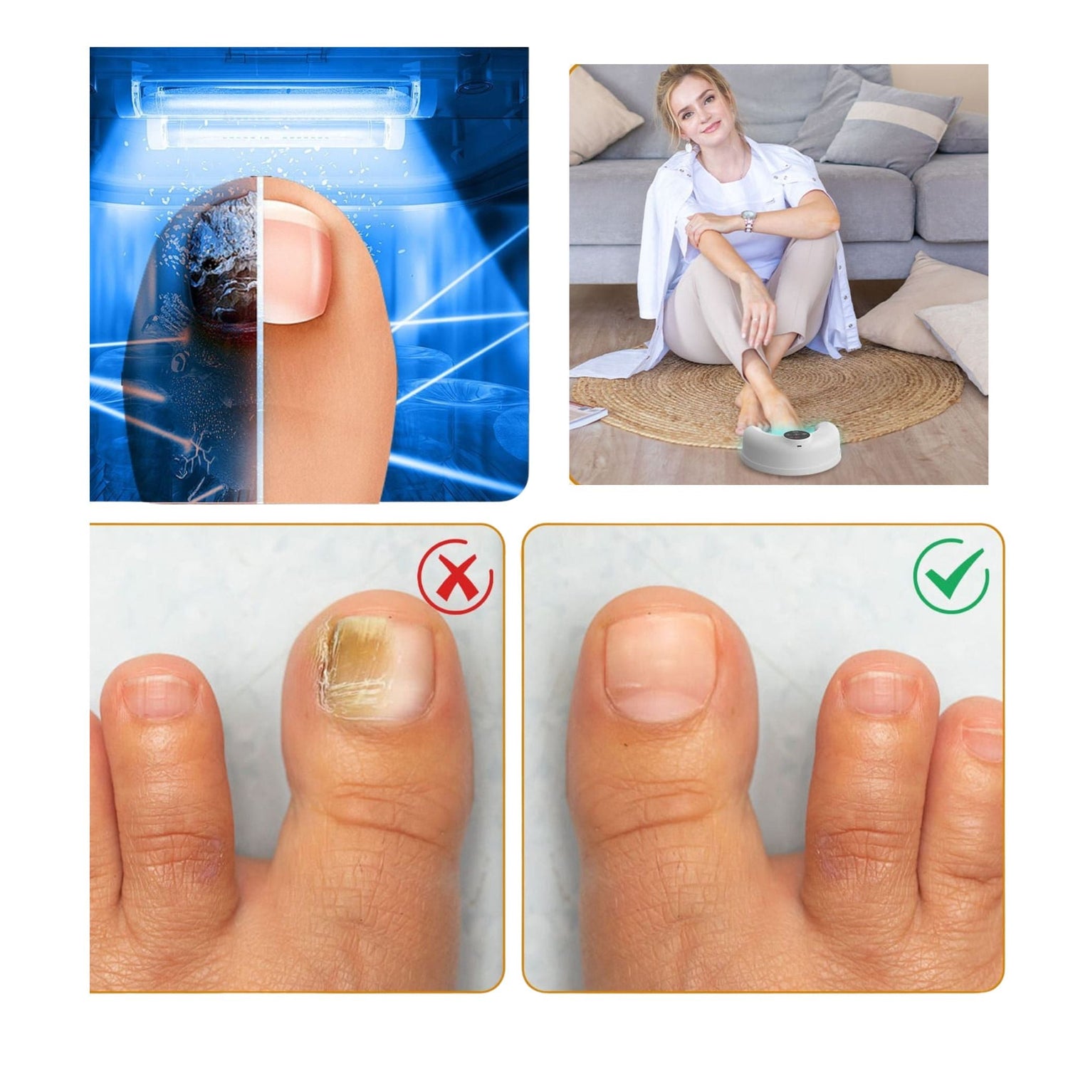 Soin ongulaire lumiere bleue